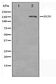 RON Antibody