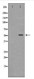 IKZF1 Antibody