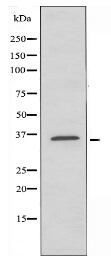 PMEPA1 Antibody