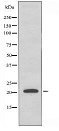 RGS5 Antibody