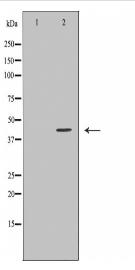 PSMD4 Antibody