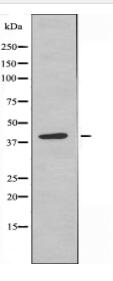 MCHR2 Antibody