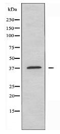 KCNK1 Antibody