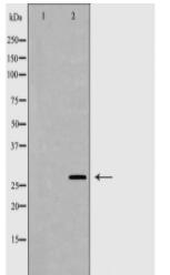MPZ Antibody