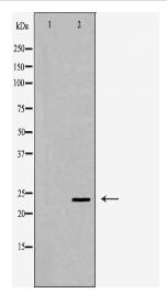 RAB5A Antibody