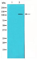 mGluR4 Antibody