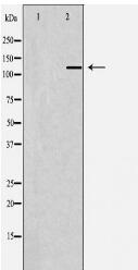 ZEB1 Antibody