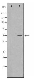 TYMP Antibody