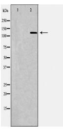 PDGFRB Antibody