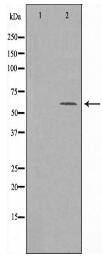 RORA Antibody