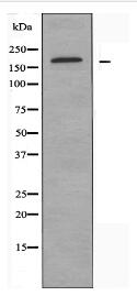 TOP2A Antibody