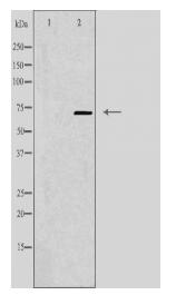 PPP2R5D Antibody