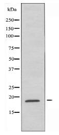 IL21 Antibody