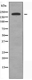 TUBGCP6 Antibody