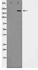 Integrin β4 Antibody