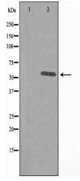 IP3KA Antibody