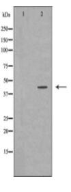 MVK Antibody