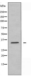 OR11G2 Antibody