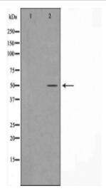 Keratin 16 Antibody