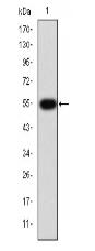 TGF β Receptor I Antibody