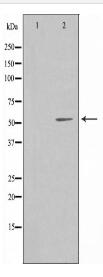 PPP2R5A Antibody