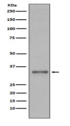 Torsin A Antibody