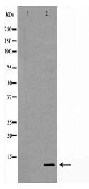 S100A11 Antibody