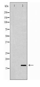 IGF-1 Antibody