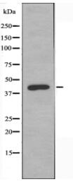 MAGEC2 Antibody