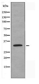 S100A5 Antibody