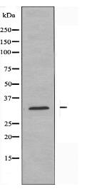 RPS3 Antibody