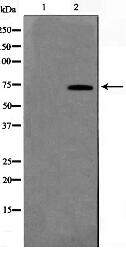 KITH_EBV Antibody