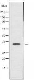 MT-ND1 Antibody