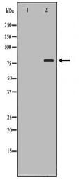 TAP2 Antibody