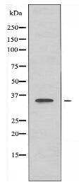 OR5AR1 Antibody