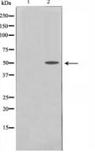 TRHR Antibody