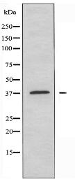 SSBP2 Antibody