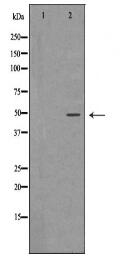 PSMC4 Antibody