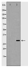 HOXB5 Antibody