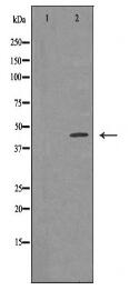 TP53 Antibody