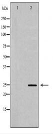 UCHL1 Antibody