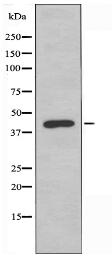 SSTR4 Antibody