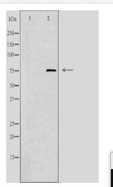 TUBGCP4 Antibody