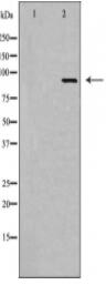 MEKKK 1 Antibody