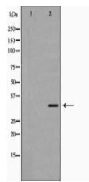 MC2R Antibody