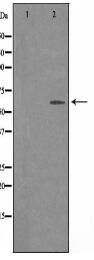 SVOP Antibody