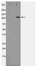 MDS1 Antibody