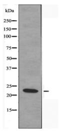 MRPL20 Antibody