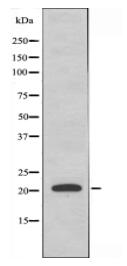 MRPL35 Antibody