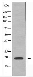 PTTG Antibody